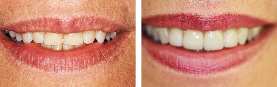 Before & After Image