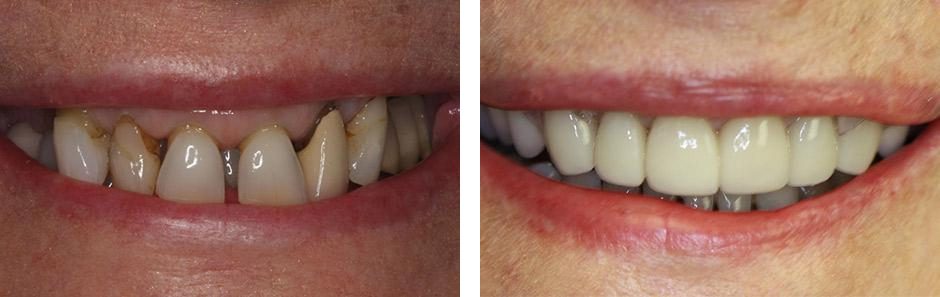 Before & After Image