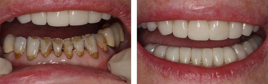 Before & After Image