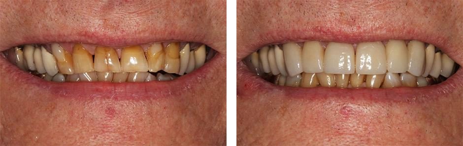 Before & After Image