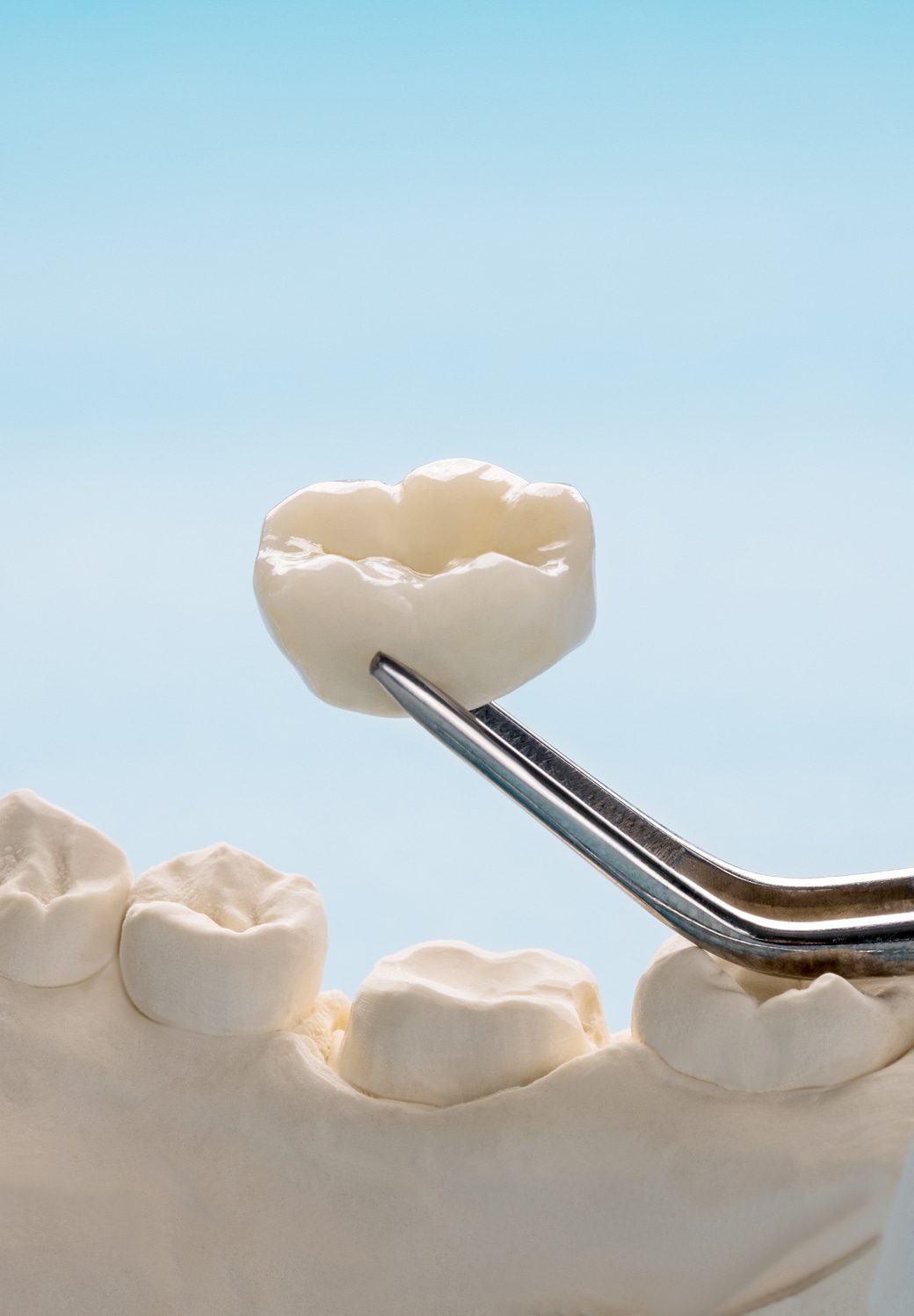 One Day Crowns Banner Image