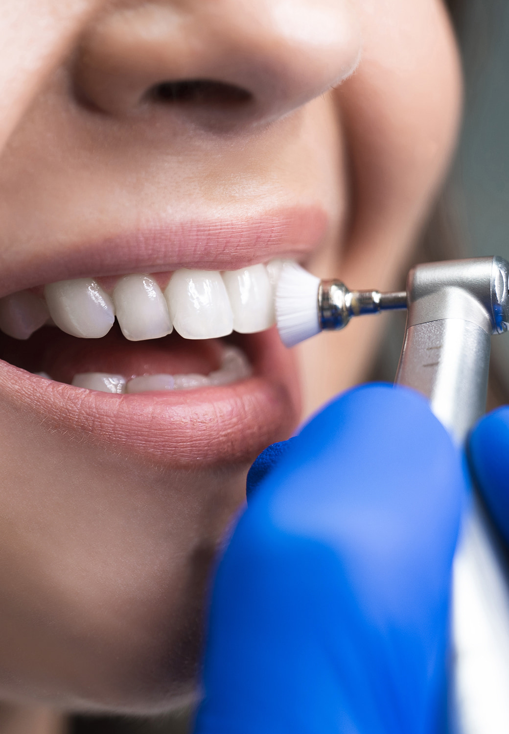 Teeth Cleaning Banner Image